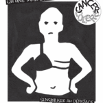 Tract Octobre Rose Cancer Colère